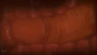 what is anime&quest;