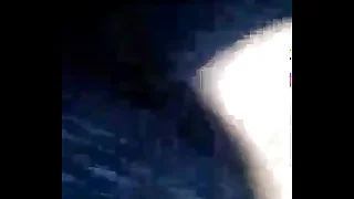 les presento mi peluda vagina y ano